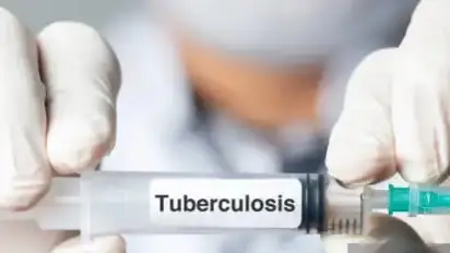 Туберкулез