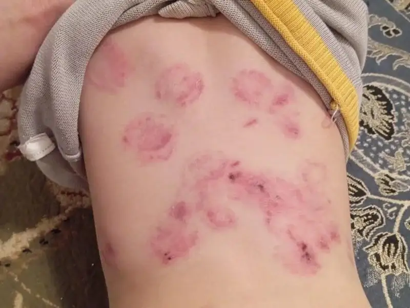 Баланы тістеген