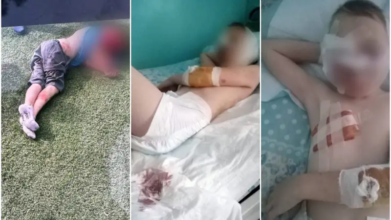 Алматы облысында 10 жасар баланы иттер талап кетті