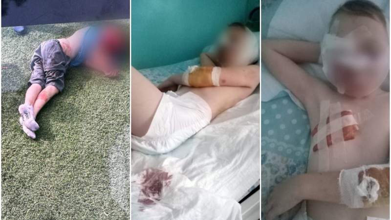 Алматы облысында 10 жасар баланы иттер талап кетті