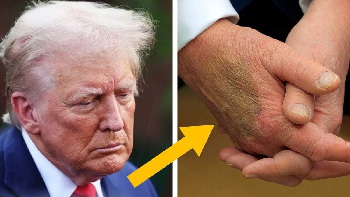 Трамп