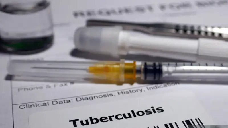 Туберкулез
