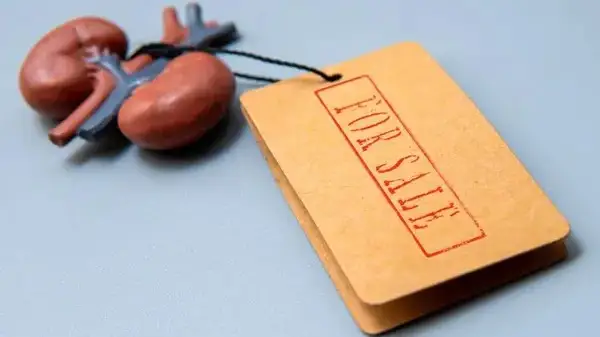 Бүйрек сату